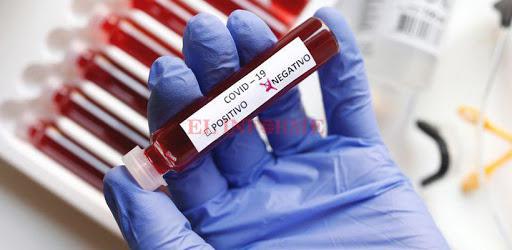 coronavirus negativo