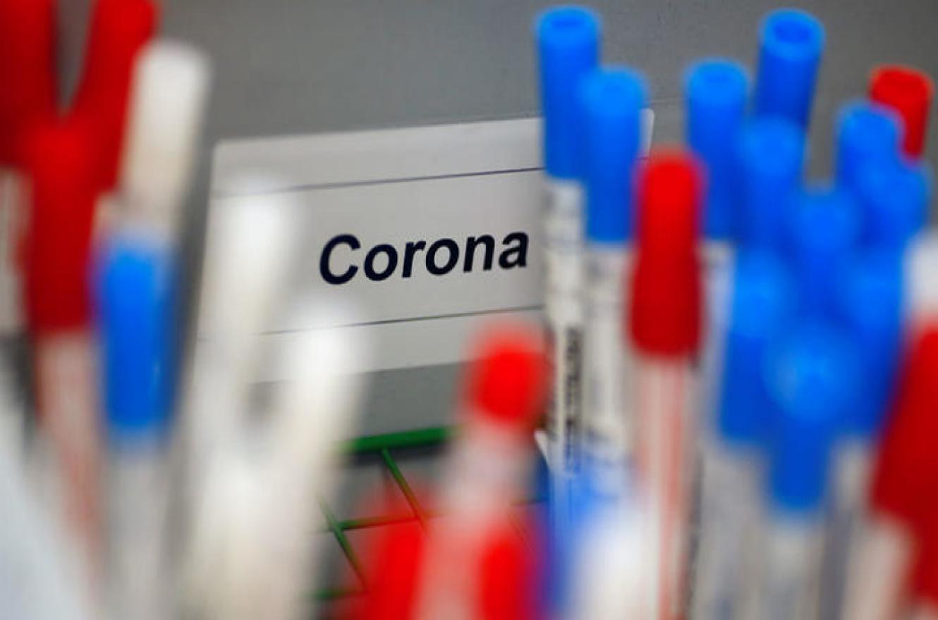 coronavirus_analisis_laboratorio (1)