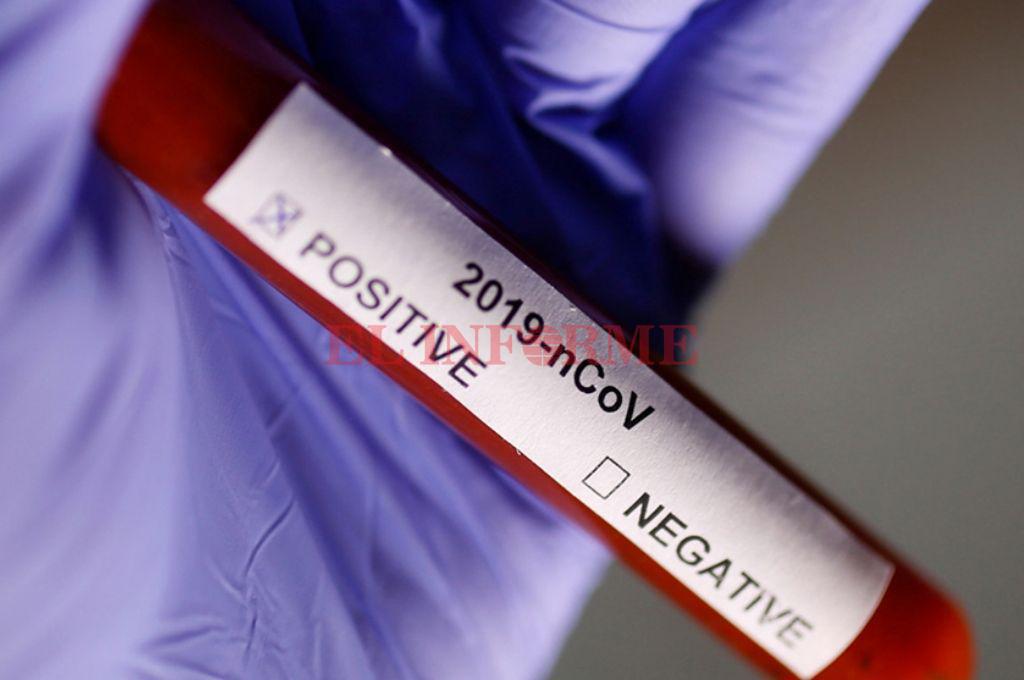 coronavirus positivo 1