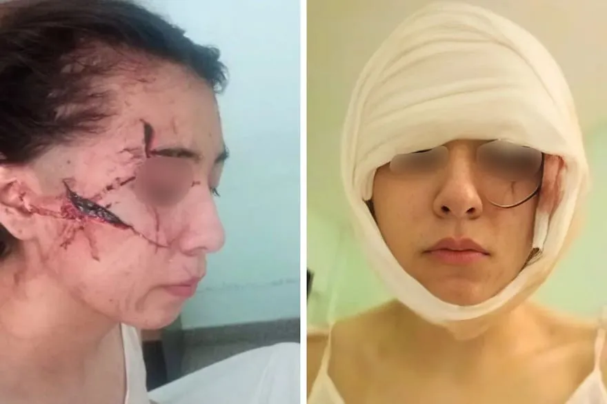 intentaron-degollarla-una-adoles