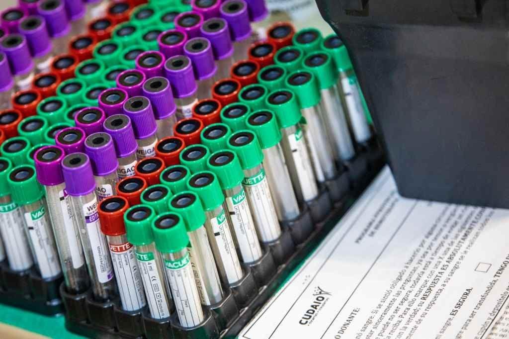 470399_laboratorio_cudaio_muestras_sangre_1024_x_680