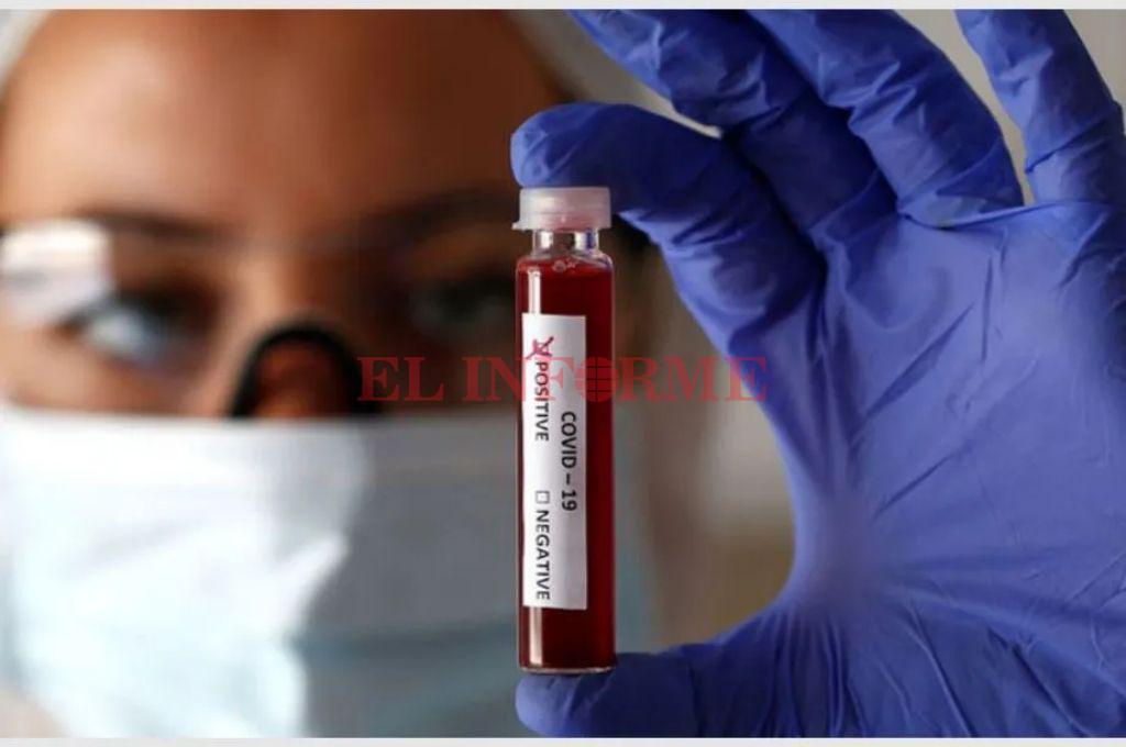 positivo coronavirussss