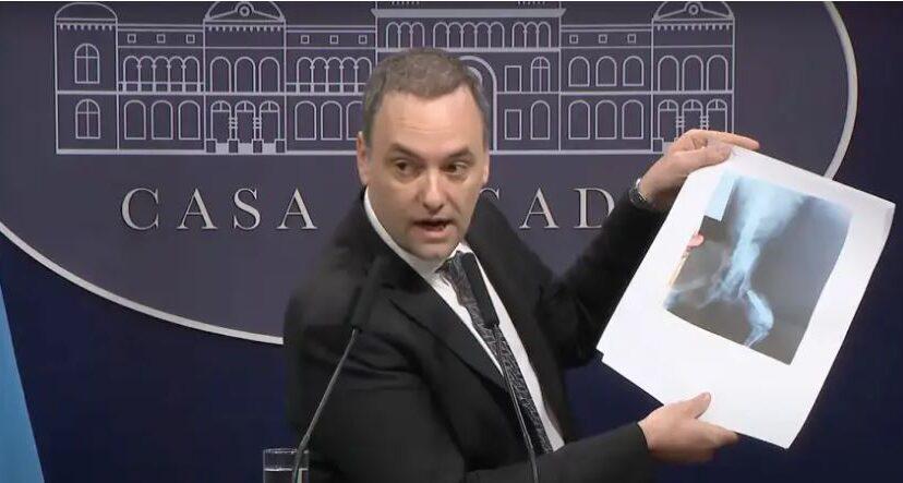 adorni-pensiones-por-invalidez-828x443