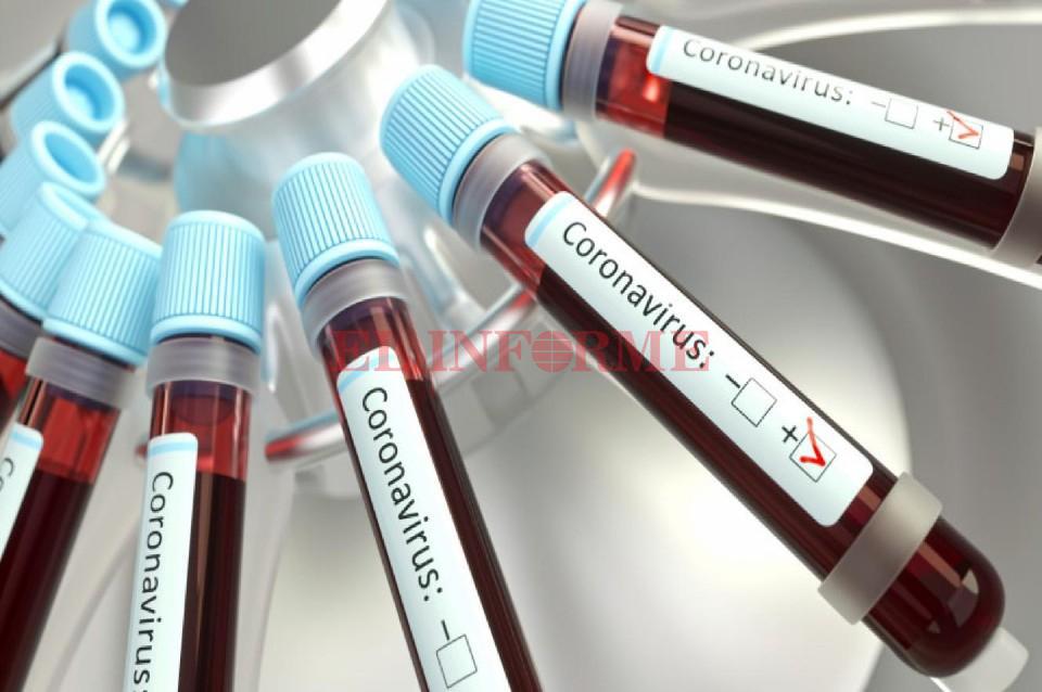 coronavirus testt