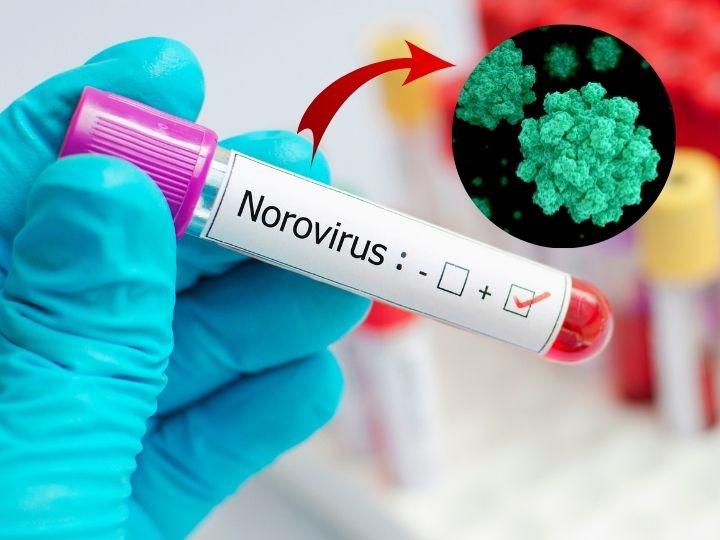 NOROVIRU