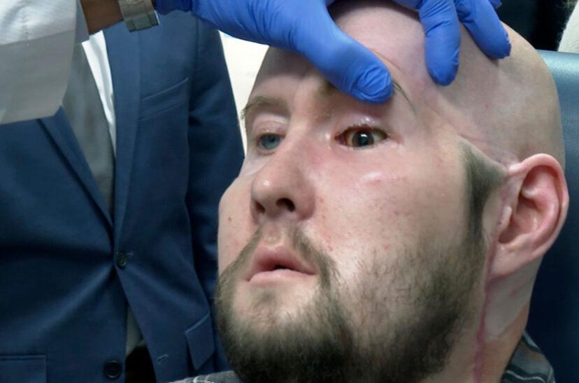 trasplante-de-ojo-828x548