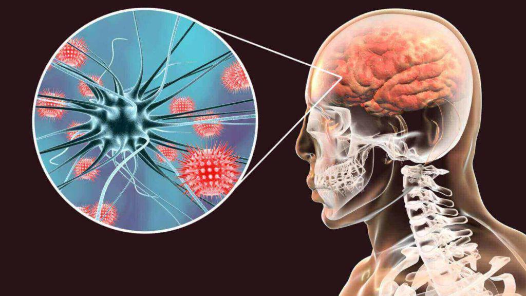 meningitis-que-es-1024x576
