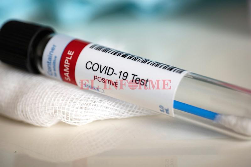 covid-19-swab-test-positive (2)