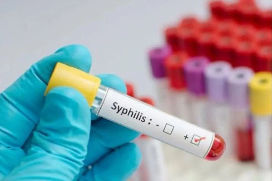 sifilis
