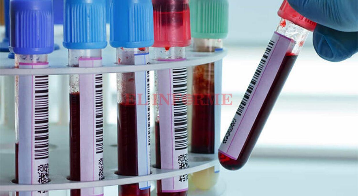 coronavirus positivo 2